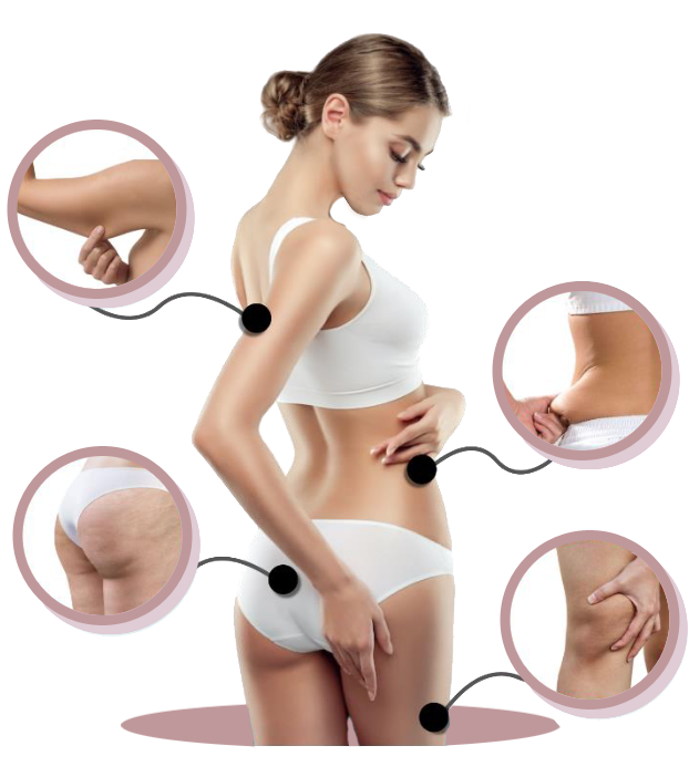 methode cryo zones pour amincissement localisé